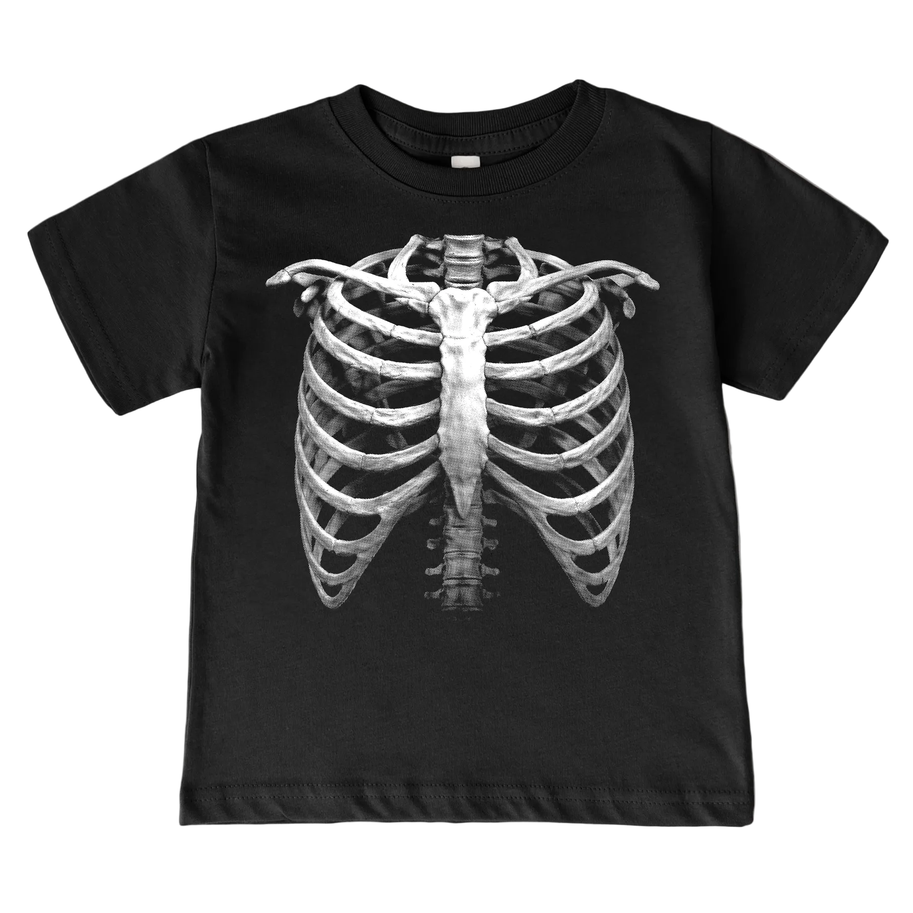 X-Ray